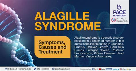 galatian syndrome|treatment for alagille syndrome.